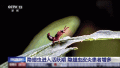 <b>若是虫体分裂当即用胶带粘除残留；现疱疹</b>